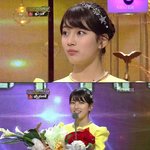 수지 <b>코</b>성형 했음?