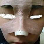 코<b>플란트</b> 코성형으로 남자가 변화합니다.