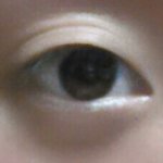 [사진 有]<b>쌍</b>커풀 수술 꼭 해야하는건가요?ㅠㅠ