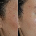 사진有<b>재석</b>) 누가 피부깨끗하면 훈녀된다고 하길래...