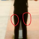 사진有)) [고민] // <b>허벅</b>지살 !! ,,, 도와주세요 ㅠㅠㅠ