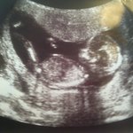 사진有) 우리집 늦둥이를 소개합니다