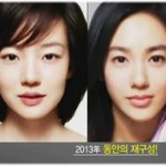 예고편에 나온..정시아씨 얼굴비율 <b>측정</b>한 박종림원장님 아시는분 있나요
