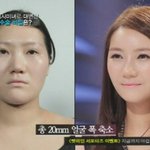 바노바기성형외과 이번엔 <b>이승연</b>과 100인의 여자 나온다던데?