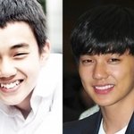 스타들의 <b>치아</b>교정 전vs후 비교