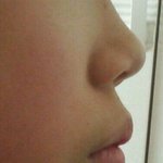 입툭튀질문입니다ㅠㅠ(<b>심란</b>有)