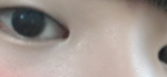 쌍수할지 말지 넘 고민이에요 ㅠㅠ 조언좀!!