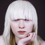 알비노 모델