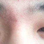<b>눈</b> 성형 고민... <b>내</b><b>눈</b> 어때요?;;;