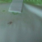 @@@@@@@@@@@@생리대 벌레 나옴ㅡㅡ@@@@@@@@@@@@
