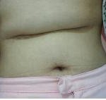 [펌] 보람이를 도와주세요..