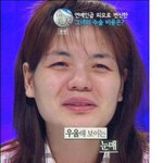 <b>성형</b> 진짜 잘한케이스
