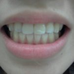 남들은 커플링!우리는 커플교정!!