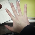 사진 ) <b>남자손</b> 이정도면 못생긴건가요?