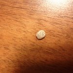 사진有 아빠가 물렸었는데 살인진드기같아요