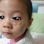 어린이집 사고관련 원장의 비상식적인 수습태도 및 의구심 세상에 알립니다...