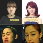 성형이 왜 욕먹냐면