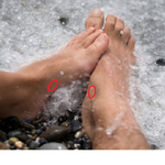 스케이트 타고나서 <b>물집</b> 공감..