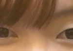 <b>이</b> <b>눈</b> 성형하면 이쁠까요?
