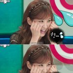 소녀시대서현성형