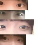 저 쌍수해야하는 눈인가요? 진지하게 봐주세요