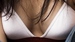 ** 이 <b>정도</b> <b>크기</b>면 성형 해야 하는건가요?? **