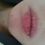 365일 <b>입술</b>상태..