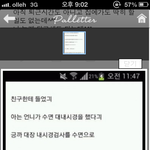 ❥❥❥수면으로 내시경받다 의사한테 한 말❥❥❥