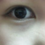 수술하고 <b>허세</b>남된내친구