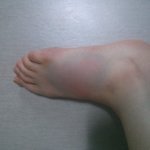 이<b>정도</b>면 금간거일까요