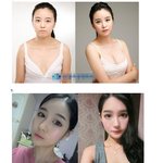 ✖✖ 여러분 일간베스트 ( <b>일베</b> ) 를 아시나요?✖✖ +) 추가