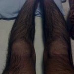다리에<b>털</b>이너무많아요 <b>사진</b>잇음