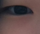 쌍커플수술 해야겟죠??