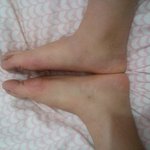 저 <b>평발</b>이에요? 사진uuuu