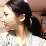제코가그렇게 수술한 코같나요?(수정)