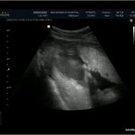 몽글아 기다려! 똑똑한 출산을 위한 <b>산모</b>교실 체험기