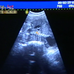 2006년의 <b>준이</b>