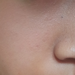 사진 유 ) 비비바를때 <b>코부분</b>에 뜬?것