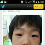 <b>준수</b>야..너  입이왜그래!!사진있음