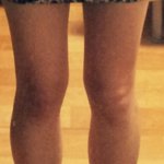 <b>종아리알</b> 진짜 미춰버리겠습니다 아주