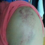 사진有) 엄마의 <b>폭언</b>과 폭행, 죽고싶습니다.