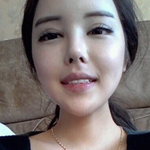 <b>성형</b> 잘됬盧 ?