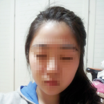 사진<b>ok</b>)이거광대튀어나온거맞죠?