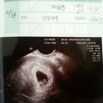 23살 초보<b>예비</b>맘입니다*^^*