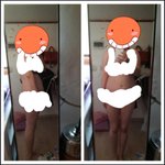 심각한 <b>복부</b> 비만 입니다.