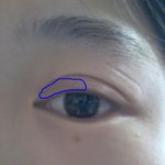 쌍커<b>풀이</b> 여러개에요ㅠㅠ제발 없애는 법 좀 알려주세요