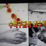 어제 비타민 보고 우리딸 수막구균성 뇌수막염인줄 알고 깜짝놀랐어요