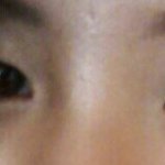 쌍커플<b>수술</b> 해야할까요? <b>사진</b>있음