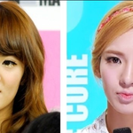 소녀시대 <b>효연</b> 무슨 성형 했나요?
