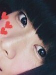 언니들 쌍수!ㅎㅎ